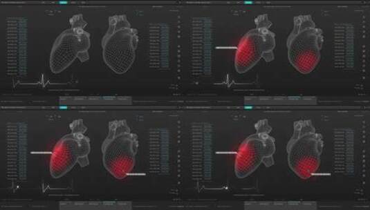 医疗心脏科幻屏幕HUD操作系统智能界面交互高清在线视频素材下载