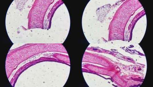 放大观察气管横切面高清在线视频素材下载