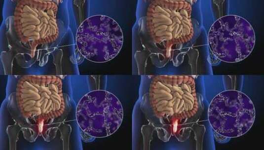 肛门上细菌的3d动画高清在线视频素材下载