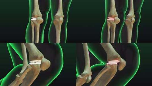 膝盖关节疼痛头颈腰椎人体骨骼3D动画高清在线视频素材下载
