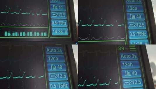 监测心率的视频高清在线视频素材下载