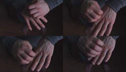 男人的手互相刮伤一种手部皮肤疾病被寄生虫高清在线视频素材下载