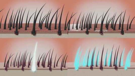 毛发与表皮细胞3D渲染高清在线视频素材下载