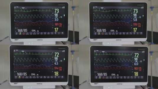 重症监护室ICU的呼吸机高清在线视频素材下载