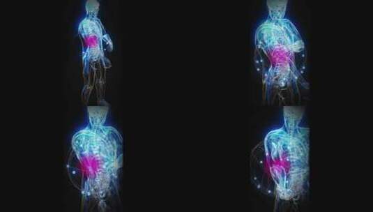 肘部疼痛男子的概念垂直3D动画高清在线视频素材下载