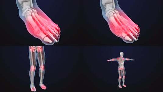 膝盖关节疼痛头颈腰椎人体骨骼3D动画高清在线视频素材下载