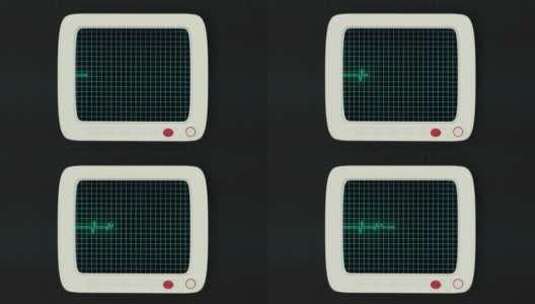 绿色屏幕上的心脏图曲线高清在线视频素材下载