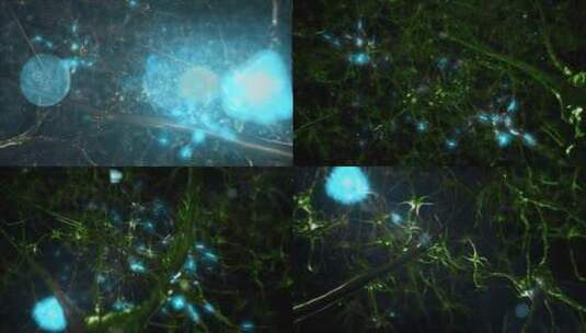 大脑神经元。带有发光链接的神经元细胞动画高清在线视频素材下载