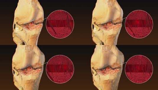 膝盖关节疼痛头颈腰椎人体骨骼3D动画高清在线视频素材下载