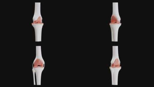 骨骼之间关节的3D动画|阿尔法频道高清在线视频素材下载