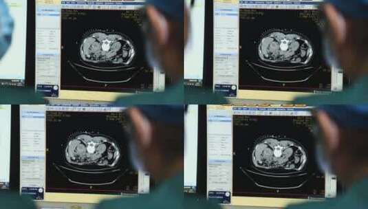 医学成像 影像 医学仪器设备 放射科 CT高清在线视频素材下载