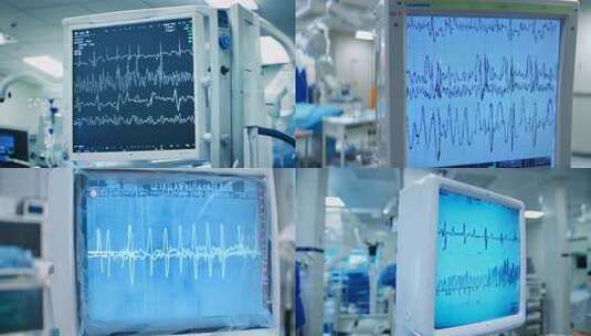 医院心电图监测屏幕画面高清在线视频素材下载