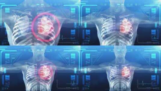 人体 器官结构三维动画展示高清在线视频素材下载