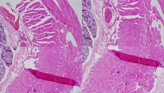 人食管横切面在明场显微镜下放大100倍高清在线视频素材下载