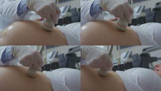 医生给孕妇做超声波检查高清在线视频素材下载