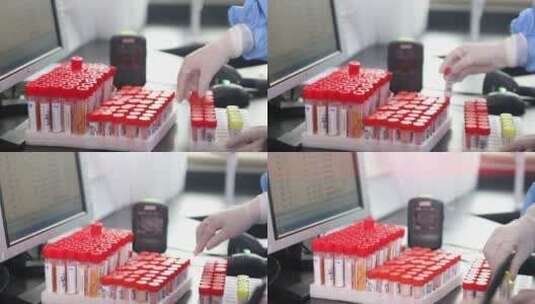 新冠疫情核酸检测医疗检验1高清在线视频素材下载