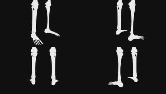胫骨后肌全拉皮环高清在线视频素材下载