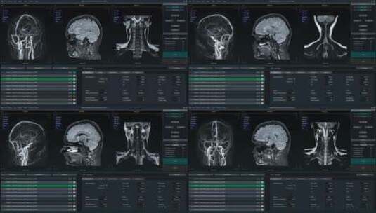 核磁共振图像扫描医疗软件界面高清在线视频素材下载