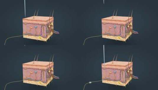 皮肤针刺神经传导神经传输退避反射高清在线视频素材下载