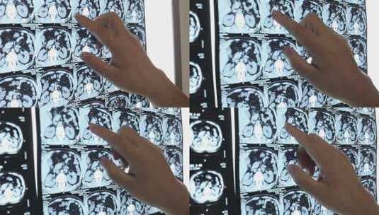 X射线胶片CT室观片灯阅片灯高清在线视频素材下载