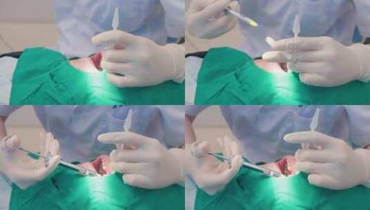 牙医为患者在口腔内注射麻药空镜高清在线视频素材下载