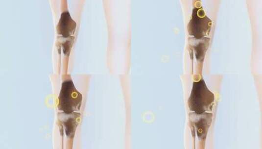 膝关节疼痛解剖医学概念3D动画高清在线视频素材下载