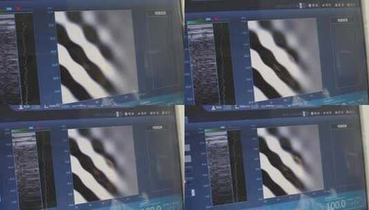 医院检验科室测量检查仪器屏幕参数值高清在线视频素材下载
