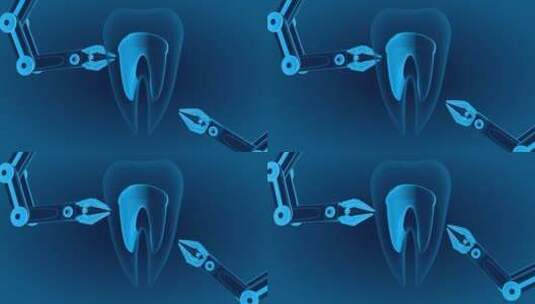 人体牙齿牙结石三维动画高清在线视频素材下载