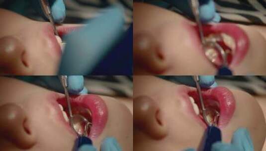 正在牙科诊所洗牙的女生口腔特写高清在线视频素材下载