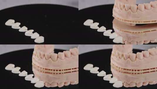 现代牙科中的牙齿贴面和塑料颌骨模型在黑色高清在线视频素材下载