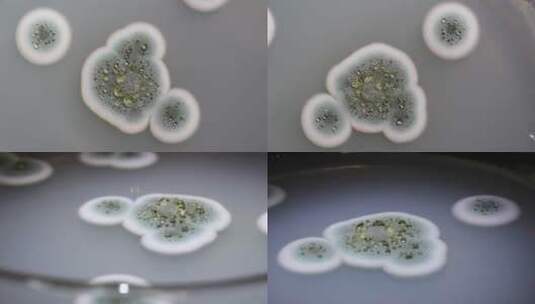 微生物学实验器材菌落展示高清在线视频素材下载