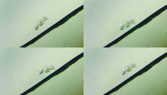 生命科学纪录片素材，显微镜下的生物，轮虫8高清在线视频素材下载