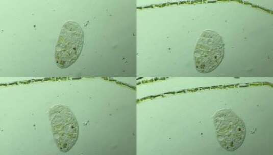 显微镜下的真实微生物 喇叭虫5高清在线视频素材下载
