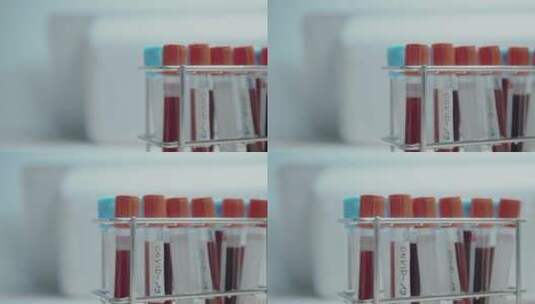 实验室里的血液试管高清在线视频素材下载