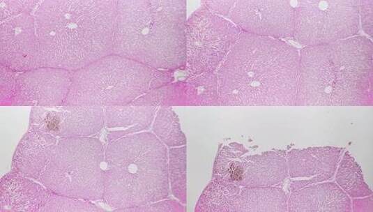 40倍放大光场显微镜下人肝切片高清在线视频素材下载