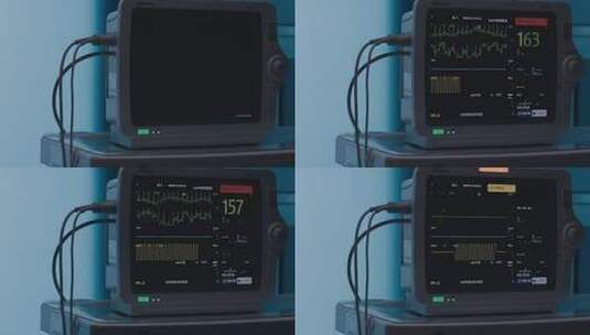 医院心电监护仪画面高清在线视频素材下载