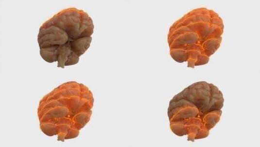 大脑、扫描、激光、科学高清在线视频素材下载