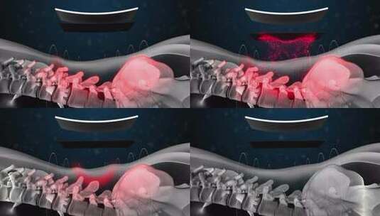 膝盖关节疼痛头颈腰椎人体骨骼3D动画高清在线视频素材下载