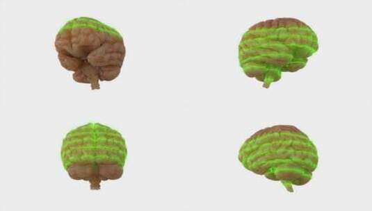 大脑、扫描、激光、科学高清在线视频素材下载