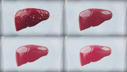 防护 肝脏  酒精肝 肝硬化 肝癌高清在线视频素材下载