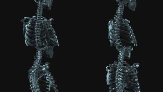 人体钢架旋转的3D医学动画高清在线视频素材下载
