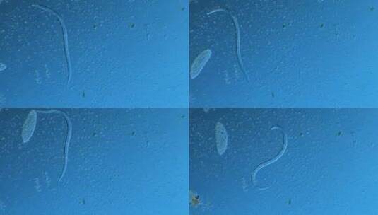 显微镜下的微观世界 线虫4高清在线视频素材下载