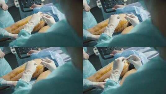 外科医生在医院手术室为病人进行静脉手术高清在线视频素材下载