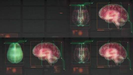 大脑扫描模拟动画高清在线视频素材下载