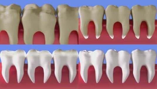 口腔卫生健康牙齿上一代牙齿美白过程3D动高清在线视频素材下载