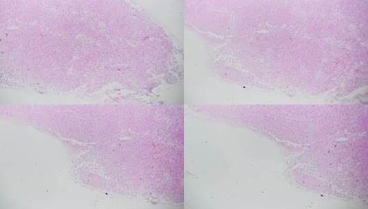 生物显微镜40x明场下人类松果体切片高清在线视频素材下载