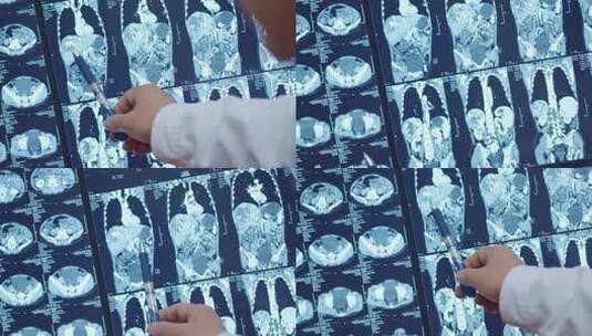彩超治疗B超CT检查医院疾病高清在线视频素材下载