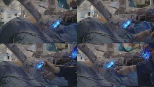 医生在用机器救治病人高清在线视频素材下载