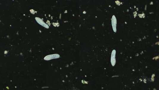 显微镜下的真实微生物 草履虫高清在线视频素材下载