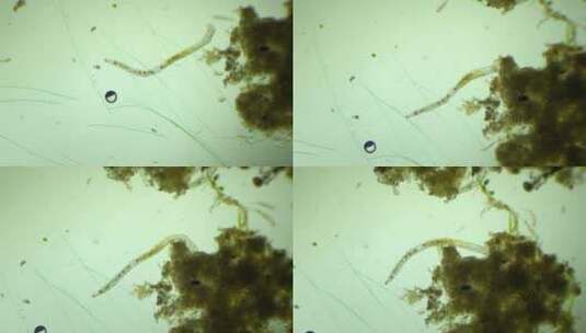 显微镜下的微观世界2高清在线视频素材下载